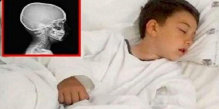 Έψησε ένα μπιφτέκι να φάει ο γιος της που πεινούσε! Λίγη ώρα αργότερα, έτρεχαν στα επείγοντα…