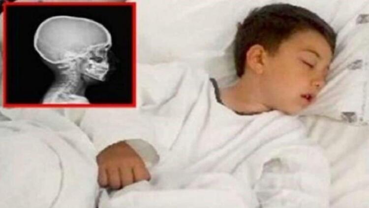 Έψησε ένα μπιφτέκι να φάει ο γιος της που πεινούσε! Λίγη ώρα αργότερα, έτρεχαν στα επείγοντα…