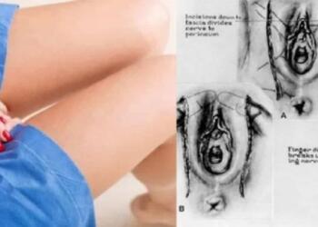 Οι Γιατροί Προειδοποιούν: Δείτε ΤΙ Συμβαίνει στον Γυναικείο Κόλπο όταν «Πιάνει Αράχνες»