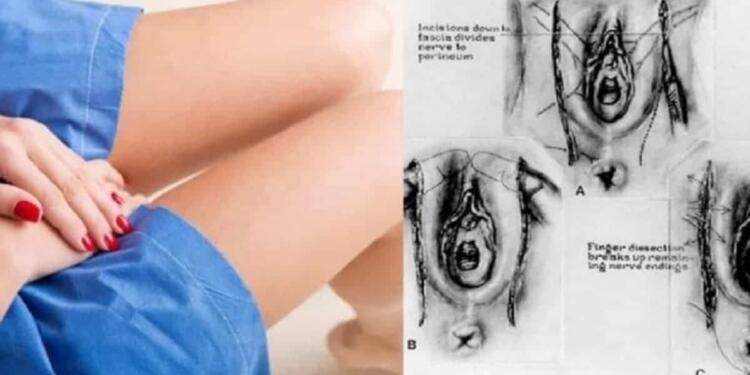 Οι Γιατροί Προειδοποιούν: Δείτε ΤΙ Συμβαίνει στον Γυναικείο Κόλπο όταν «Πιάνει Αράχνες»