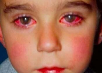 8χρονος έχασε την όρασή του από ένα παιχνίδι που όλοι έχουμε αγοράσει!