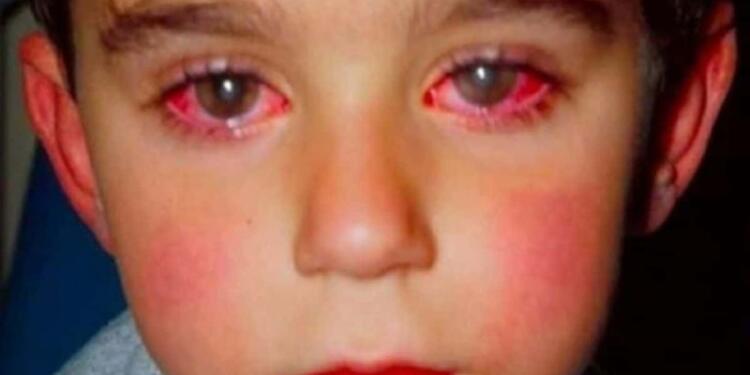 8χρονος έχασε την όρασή του από ένα παιχνίδι που όλοι έχουμε αγοράσει!