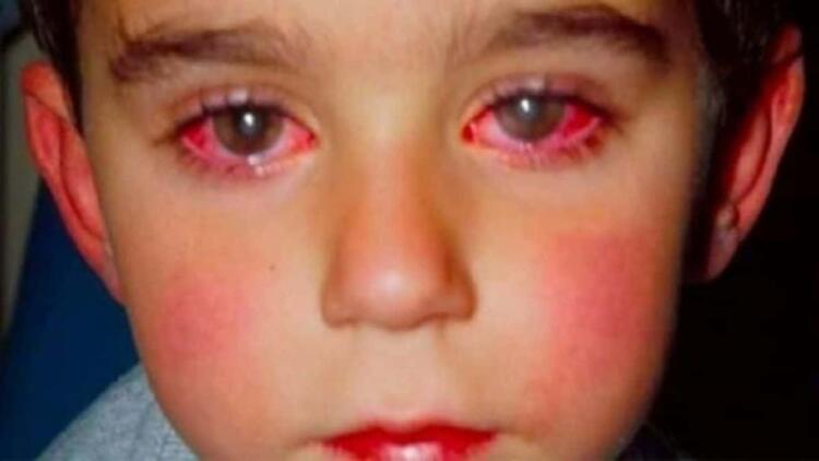 8χρονος έχασε την όρασή του από ένα παιχνίδι που όλοι έχουμε αγοράσει!