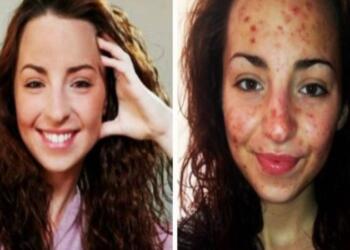 20χρονη έκανε κάτι που κάνουμε όλοι καθημερινά για 6 ώρες την ημέρα – Τι της συνέβη; Σοκαριστικό