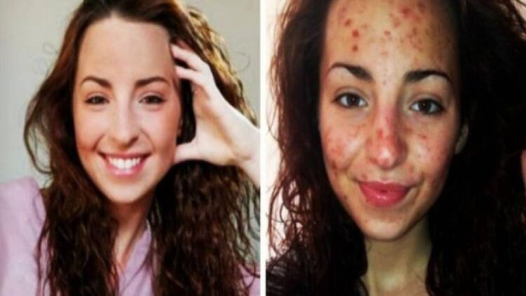 20χρονη έκανε κάτι που κάνουμε όλοι καθημερινά για 6 ώρες την ημέρα – Τι της συνέβη; Σοκαριστικό