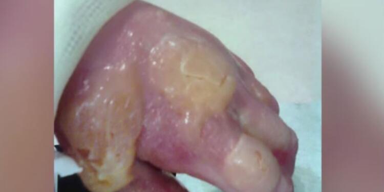 Άγγιξε αυτό το κοινό φυτό, ξεκίνησε να πρήζεται και κατέληξε στην εντατική – Θα μείνετε όταν δείτε ποιο είναι