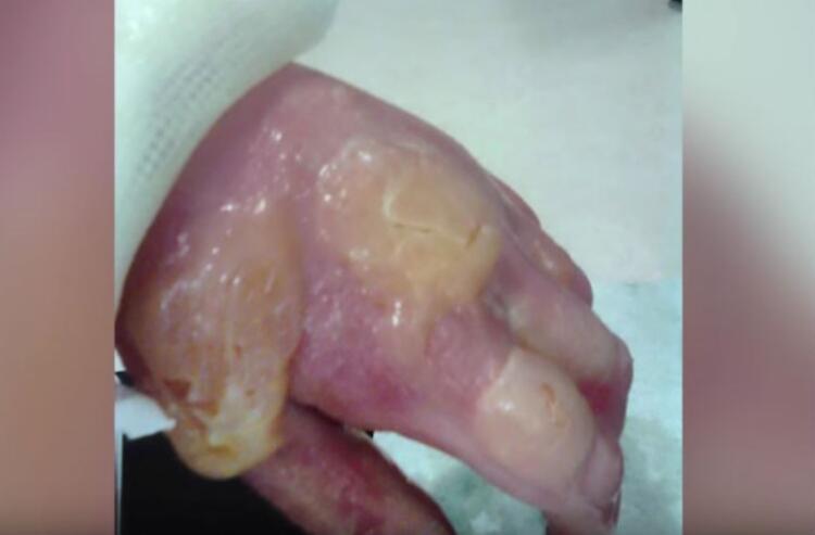 Άγγιξε αυτό το κοινό φυτό, ξεκίνησε να πρήζεται και κατέληξε στην εντατική – Θα μείνετε όταν δείτε ποιο είναι