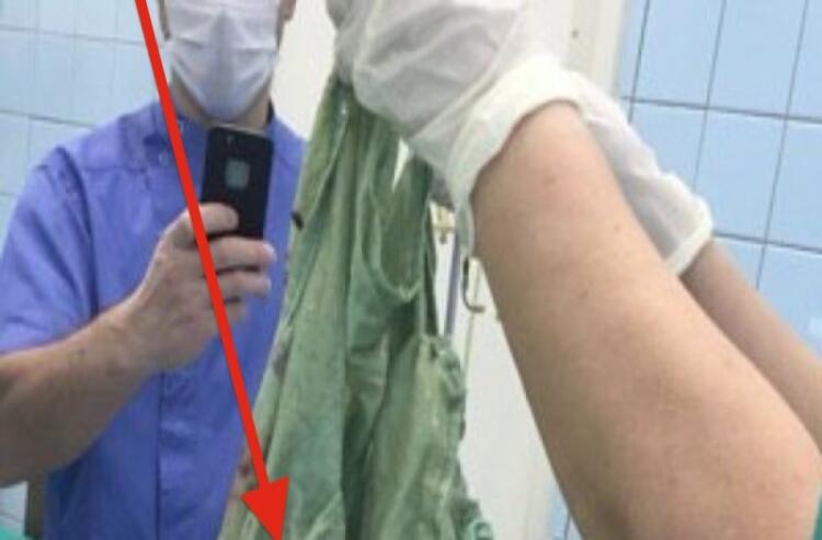 Η κοιλιά της 34χρονης δεν σταματούσε να μεγαλώνει – Όταν την άνοιξαν οι γιατροί, έπαθαν σοκ