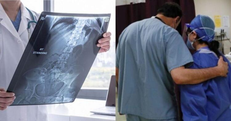 Τα ‘χασαν ακόμα κι οι γιατροί με αυτό που είδαν στο στομάχι 18χρονης