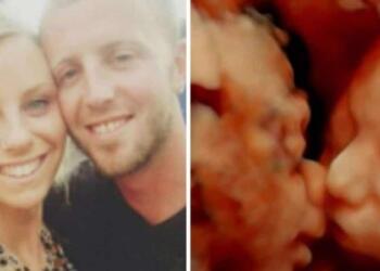 24χρονη έγκυος πήγε για υπερηχογράφημα – Μόλις κοίταξε την οθόνη πάγωσε