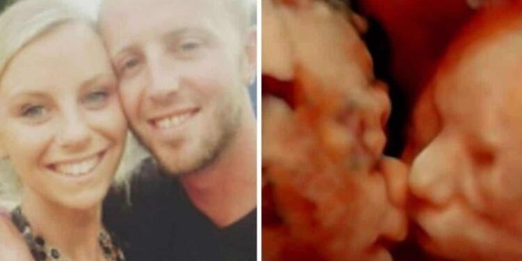 24χρονη έγκυος πήγε για υπερηχογράφημα – Μόλις κοίταξε την οθόνη πάγωσε