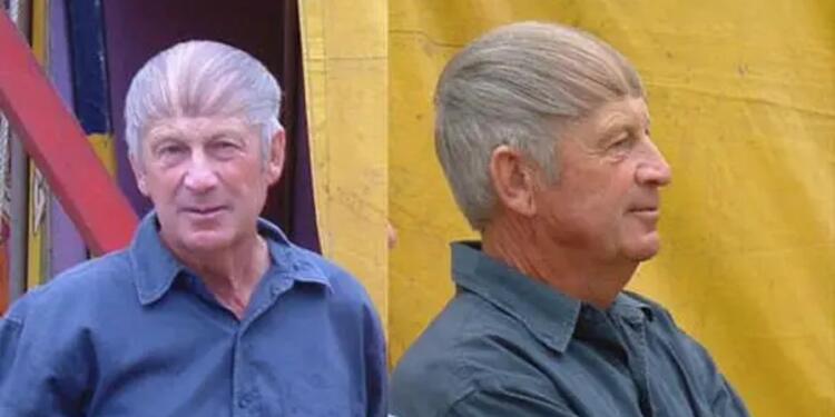 12 Φωτογραφίες ανδρών που δεν μπορούν να αποδεχτούν την απώλεια των μαλλιών …