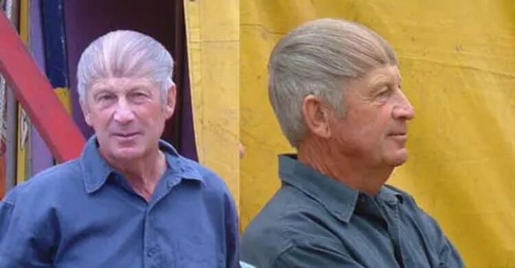 12 Φωτογραφίες ανδρών που δεν μπορούν να αποδεχτούν την απώλεια των μαλλιών …