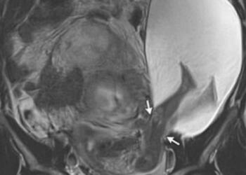27χρονη έγκυος ήταν έτοιμη να γεννήσει – Όμως αυτό που έκανε το μωρό παραλίγο να της στοιχίσει τη ζωή
