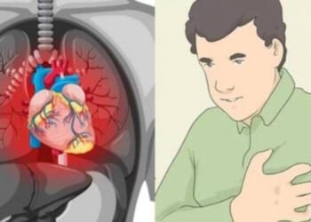 «Σιωπηλό» έμφραγμα: Τα συμπτώματα που οι περισσότεροι αγνοούν