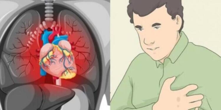 «Σιωπηλό» έμφραγμα: Τα συμπτώματα που οι περισσότεροι αγνοούν