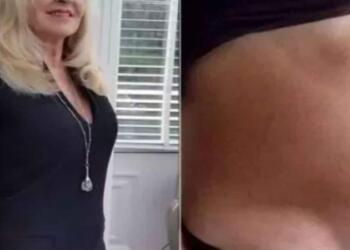 66χρονη πηγαίνει στο νοσοκομείο νομίζοντας πως είναι έγκυος – Όταν οι γιατροί της είπαν την αλήθεια «πάγωσε»…