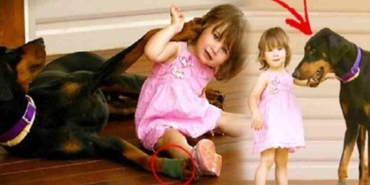 Σκύλος δάγκωσε την 17 μηνών κόρη της και την πέταξε μακριά – Μόλις κατάλαβε γιατί το είχε κάνει «πάγωσε»