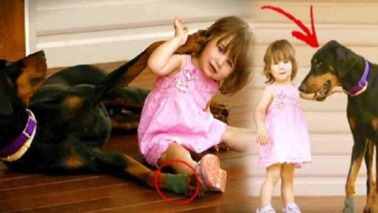 Σκύλος δάγκωσε την 17 μηνών κόρη της και την πέταξε μακριά – Μόλις κατάλαβε γιατί το είχε κάνει «πάγωσε»