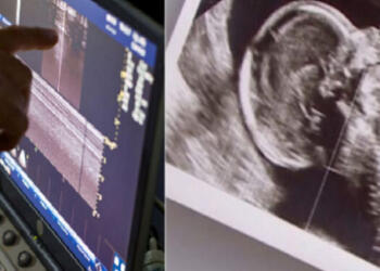 Συγκλονιστικό: Ζευγάρι με δίδυμα περιμένει και πάλι παιδί, αλλά ο γιατρός δείχνει το υπερηχογράφημα και ο σύζυγος αμέσως λιποθυμά