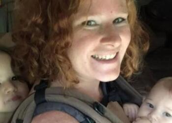 Όταν έμεινε έγκυος κάτι παράξενο φύτρωσε στο μέτωπό της – Αυτό που της αφαίρεσαν οι γιατροί τους έκανε να “παγώσουν”