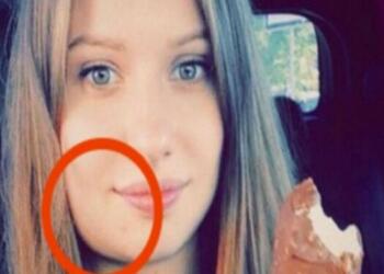 Αυτή η έγκυος ξύπνησε και είδε το σαγόνι της πρησμένο – Μόλις πήγε στο νοσοκομείο…Ανατριχιαστικό!