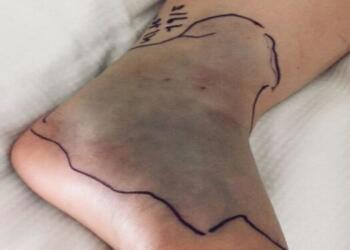 Όταν είδε το παιδί της σε αυτή την κατάσταση, της κόπηκαν τα πόδια!