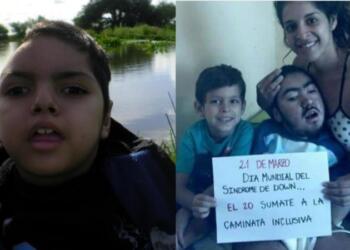 Στα 25 της υιοθέτησε ένα παιδί με αναπηρίες – Όταν του έκανε το πρώτο μπάνιο ένιωσε κάτι ανατριχιαστικό στο κεφάλι του (photo)