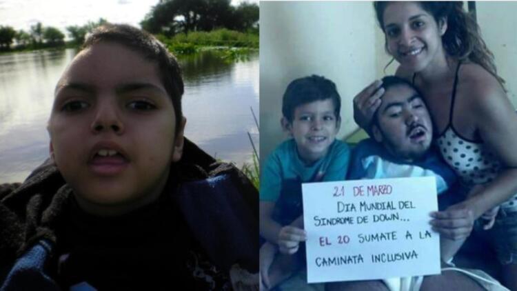 Στα 25 της υιοθέτησε ένα παιδί με αναπηρίες – Όταν του έκανε το πρώτο μπάνιο ένιωσε κάτι ανατριχιαστικό στο κεφάλι του (photo)