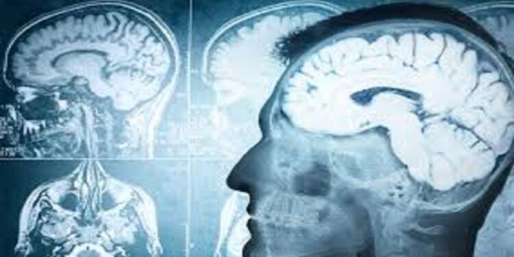 Άνοια: Το πρώτο «αθώο» σύμπτωμα που προειδοποιεί ότι χάνουμε το μυαλό μας
