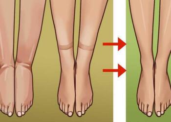 Τέλος στο πρήξιμο! Αυτά είναι τα τρόφιμα που προκαλούν κατακράτηση υγρών