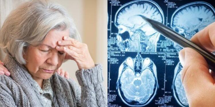 Άνοια: Η πασίγνωστη βιταμίνη που σώζει το μυαλό των 80ρηδων