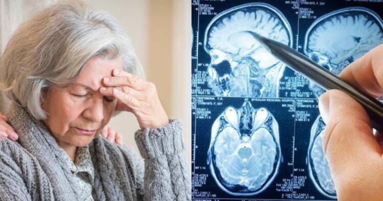 Άνοια: Η πασίγνωστη βιταμίνη που σώζει το μυαλό των 80ρηδων