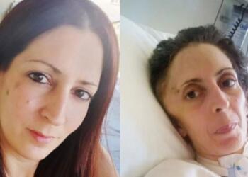 Αργυρούπολη: Πέθανε η 41χρονη Όλγα που είχε ξυλοκοπηθεί άγρια από τον τζουντόκα πρώην σύντροφό της