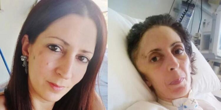 Αργυρούπολη: Πέθανε η 41χρονη Όλγα που είχε ξυλοκοπηθεί άγρια από τον τζουντόκα πρώην σύντροφό της