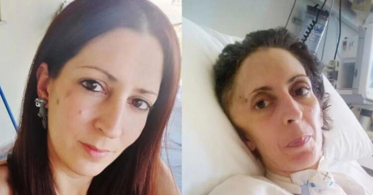 Αργυρούπολη: Πέθανε η 41χρονη Όλγα που είχε ξυλοκοπηθεί άγρια από τον τζουντόκα πρώην σύντροφό της