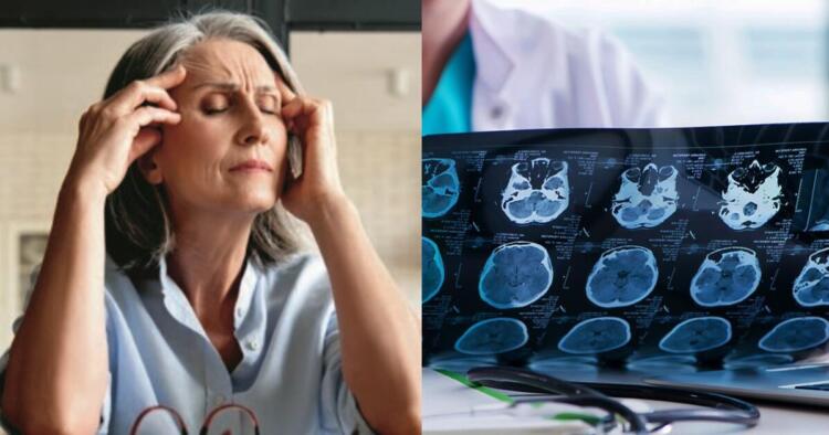 9 πράγματα που μπορείτε να κάνετε σήμερα για να μην πάθετε Αλτσχάιμερ όταν γεράσετε