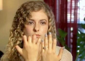 27χρονη Χάνει Ξαφνικά Τα Δάχτυλά Της Σήμερα Προειδοποιεί Όλες Τις Γυναίκες Για Αυτόν Κίνδυνο -ΒΙΝΤΕΟ