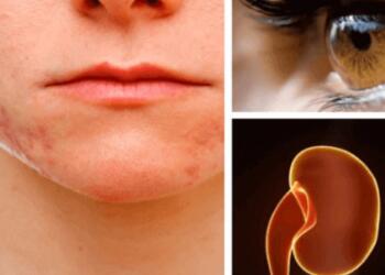 Ποια όργανα επηρεάζει το στρες περισσότερο και γιατί