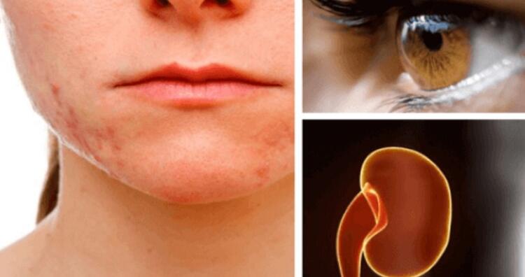 Ποια όργανα επηρεάζει το στρες περισσότερο και γιατί