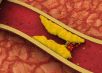 10 τροφές που καθαρίζουν τις αρτηρίες και σε προστατεύουν από καρδιακές επιπλοκές!