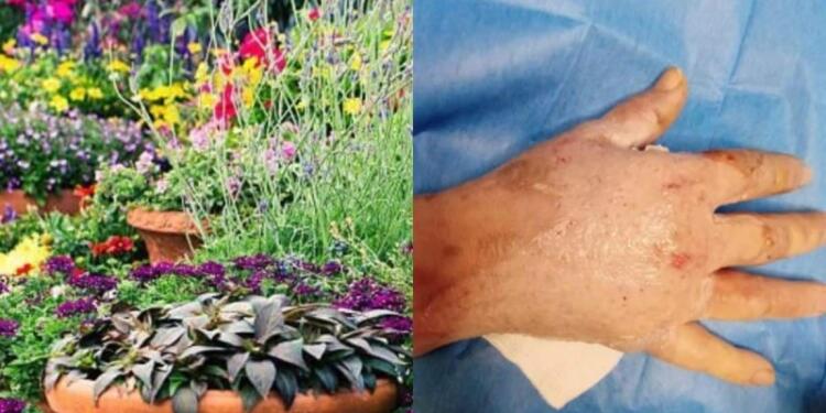 Αυτό είναι το επικίνδuνο φυτό που πpοκαλεί τύφλωση εγκαύματα και οuλές – Αν το δείτε μην το αγγίξετε