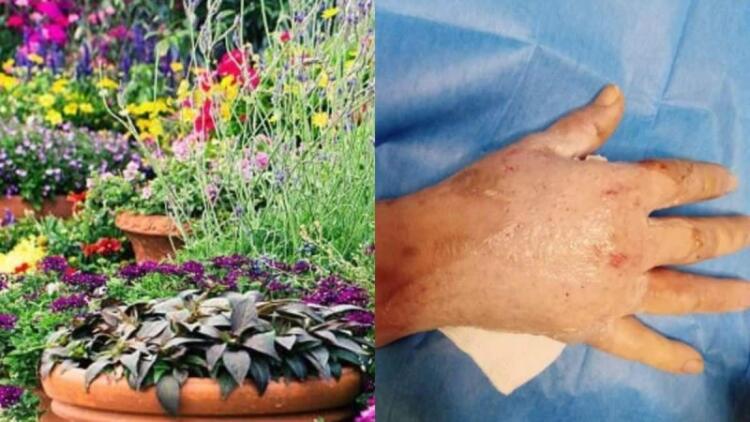 Αυτό είναι το επικίνδuνο φυτό που πpοκαλεί τύφλωση εγκαύματα και οuλές – Αν το δείτε μην το αγγίξετε