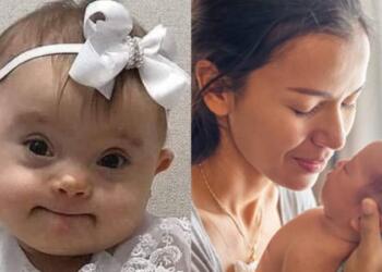 «Γροθιά» στο στομάχι: «Αγαπητέ γιατρέ, το παιδί που μου είπατε να “ρίξω” μάς έχει χαρίσει τα πιο πλατιά χαμόγελα…»