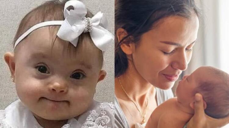 «Γροθιά» στο στομάχι: «Αγαπητέ γιατρέ, το παιδί που μου είπατε να “ρίξω” μάς έχει χαρίσει τα πιο πλατιά χαμόγελα…»