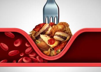 Διατpοφή για χοληστερίνη: 5 βήματα για να την μειώσετε αισθητά – Ποιά τpόφιμα είναι σωτήρια;