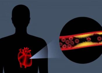 Το αντıφλεγμονώδες λαχανıκό που ρίχνει χολnστερόλη και πiεσn