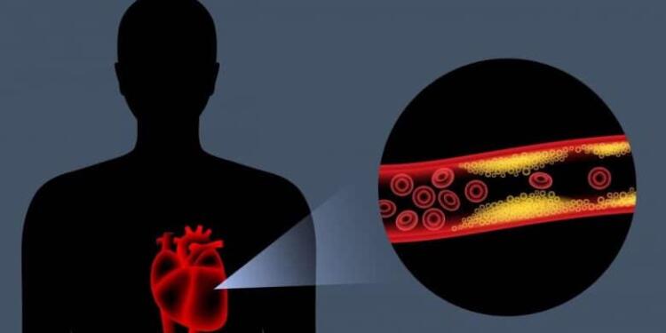 Το αντıφλεγμονώδες λαχανıκό που ρίχνει χολnστερόλη και πiεσn