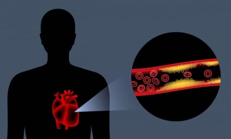 Το αντıφλεγμονώδες λαχανıκό που ρίχνει χολnστερόλη και πiεσn