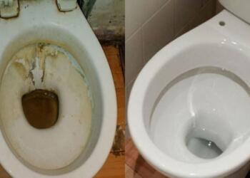 Πουρί και κιτρινίλα στον πάτο της λεκάνης – Kάντε την σαν καινούρια με 3 υλικά που όλοι έχουμε στο σπίτι